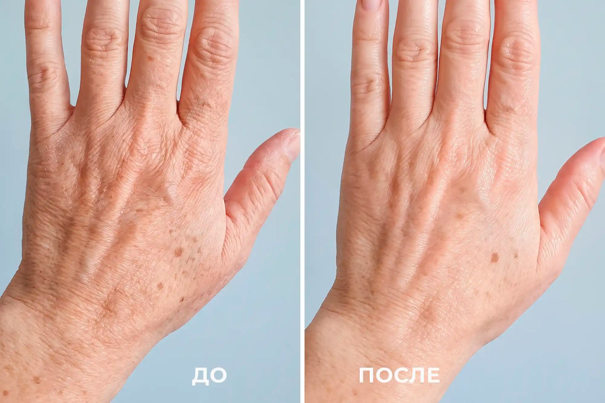 LED HAND