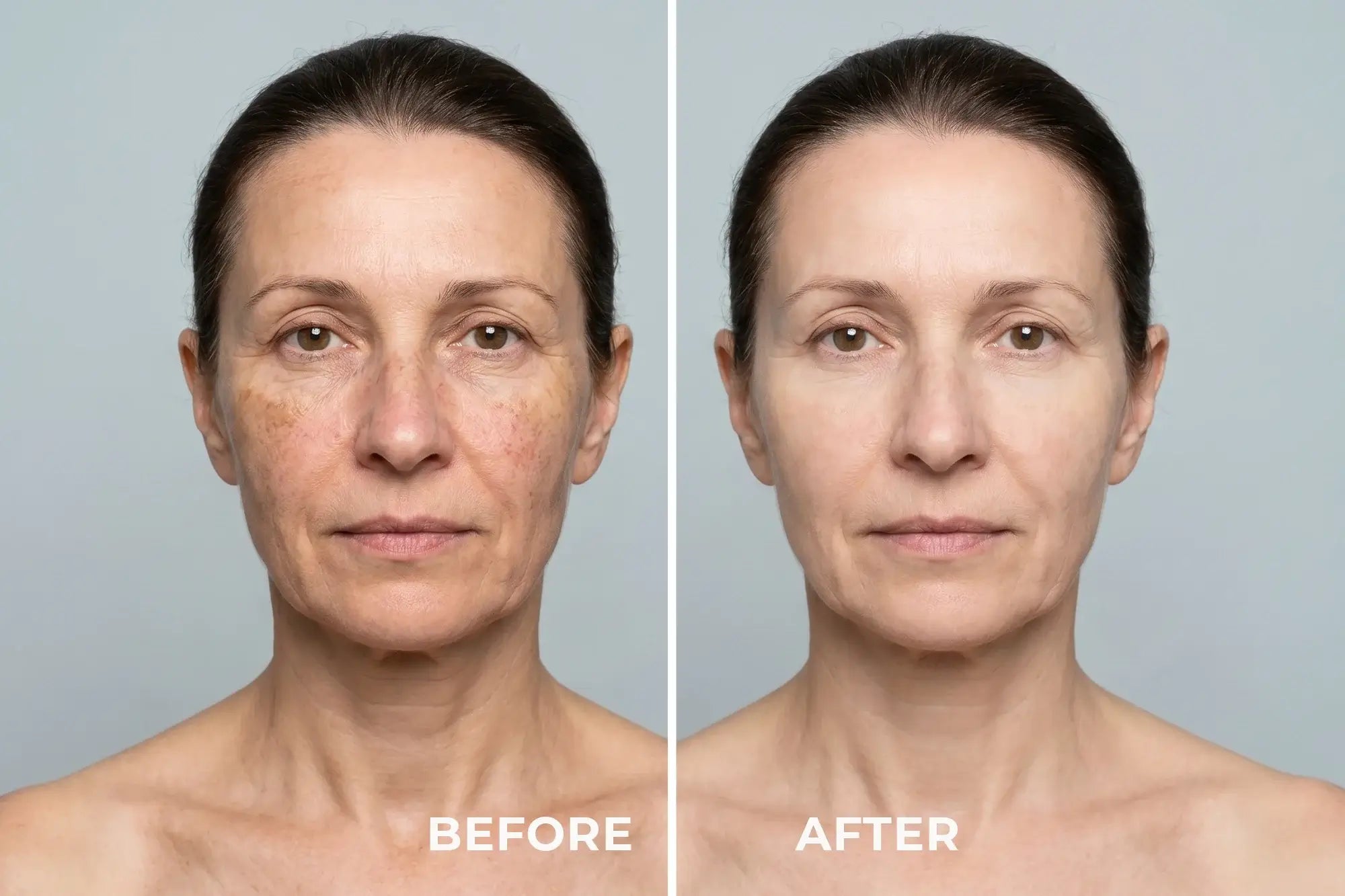 LED SET - PHOTOTHERAPY MASK FOR THE FACE AND DECOLLETAGE AREA